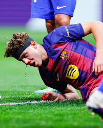 Fermín López after his clash with Juan Musso 😳