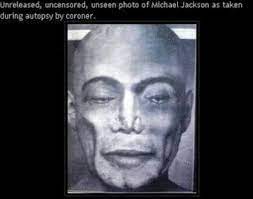 Maybe you would like to learn more about one of these? Autopsy Photograph Of Michael Jackson