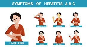 Image result for hepatitis symptoms