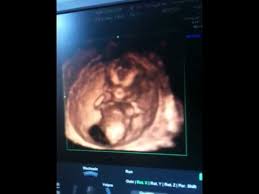 Russell brand wird seiner tochter kein geschlecht aufzwingen. Unser Wurmchen 13 Ssw Youtube