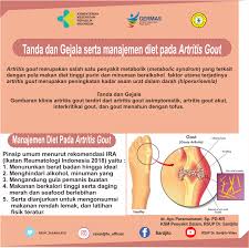 Kondisi tersebut merupakan dampak dari hipertensi yang berakibat pada pembekuan darah di bola mata. Rsup Dr Sardjito Tanda Dan Gejala Serta Manajemen Diet Pada Artritis Gout