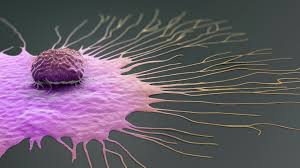 Cancer center with more than 100 types of cancer, understanding your treatment options can be overwhelming. Electromagnetic Fields Hinder Spread Of Breast Cancer Study Shows