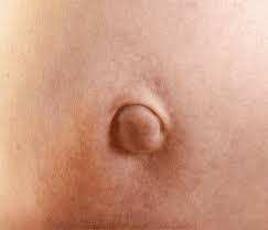 We did not find results for: Everything You Need To Know About Having Your Umbilical Hernia Repair With Mesh Umbilical Hernia Surgery Recovery