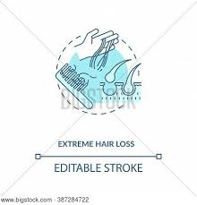 The severity of hair loss can vary from a small area to the entire body. Extreme Hair Loss Vector Photo Free Trial Bigstock