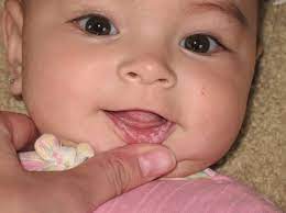 Keputihan pada dasarnya dapat digolongkan menjadi dua golongan yaitu keputihan normal (fisiologis) dan keputihan abnormal (patologis). Lidah Bayi Putih Ini 5 Perkara Yang Anda Patut Buat