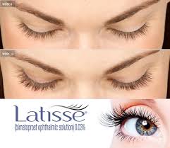 Typically, it takes several weeks to start seeing eyelash growth by stimulating the hair growth cycle, says few. Latisse Winnipeg The Derm Centre