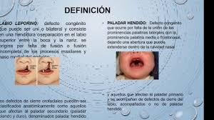 Según la asociación operación sonrisa perú, unos 3.500 niños con estas condiciones se encuentran. Paladar Hendido Quinto Magisterio Dia Lunes Youtube
