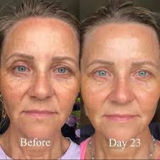 ✨As many of you know, I have been