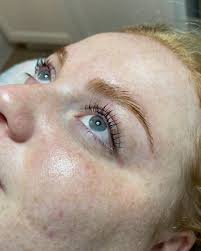 TWO YEARS 🎉, It seems like fate that my very first esthetics conference  falls