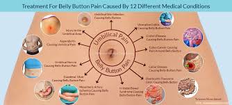 Treatment For Belly Button Pain Caused By 12 Different Medical Conditions