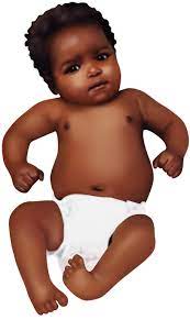 Babies born with 'spina bifida' or open spine may also suffer from a. Clubfoot Healthdirect