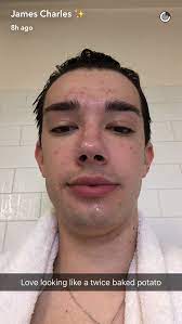 Pin By Chloe Sawyer On James Charles 3 James Charles Charles Meme Charles James