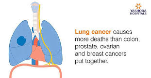 Lung cancer symptoms may include— coughing that gets worse or doesn't go away. Lung Cancer Causes Symptoms And Treatment