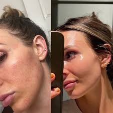 Reviews of Moon Lux Skin & Wellness