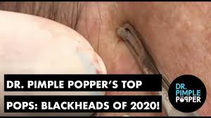 Insider via yahoo news· 2 months ago. Dr Pimple Popper S Top Pops Blackheads Youtube