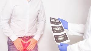 Erkrankungen An Der Prostata Ab Wann Ist Eine Operation Notig Krankenhaus De