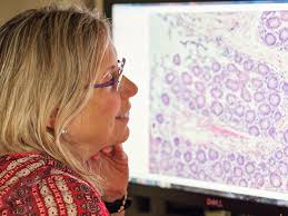 Breast Reconstruction After Radiation: Autologous VS Implants