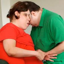 Who were conjoined twins George and Lori Schappell?