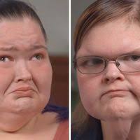 This bald hedgehog has a much better life than you