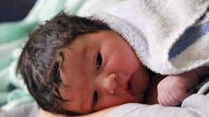 È un segnale di sviluppo nel piccolo, su cui non serve nessuna apprensione, . Perdita Capelli Neonato Perche Succede C E Da Preoccuparsi