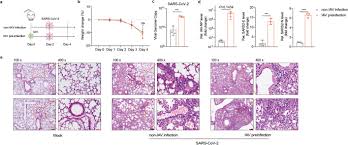Check spelling or type a new query. Coinfection With Influenza A Virus Enhances Sars Cov 2 Infectivity Cell Research