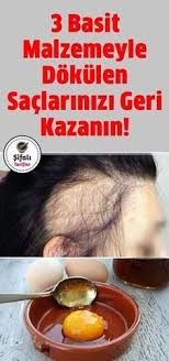 Insanlar Sac Dokulmesini Ve Kelligi Hep Yaslilikla Iliskilendirirler Bu Durum Belki Yillar Oncesinde Gecerliydi Ama Gunumuz Sac Sac Dokulmesi Dogal Sac Bakimi