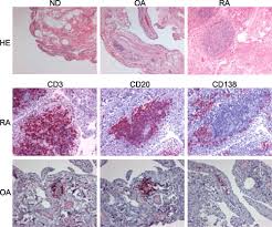 Kantor kraków, kalwaryjska 36 (podgórze). Molecular Signatures And New Candidates To Target The Pathogenesis Of Rheumatoid Arthritis Physiological Genomics