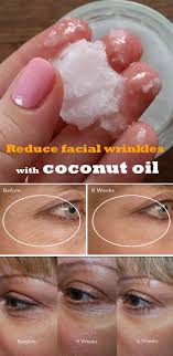 Reduce Facial Wrinkles With Coconut Oil In 2020 Coconut Oil Diy Beauty Facial Wrinkles Diy Beauty Hacks