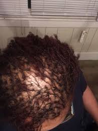 What hairstyles for long thin hair would work best for you? The Top Of My Head With Sister Locs I Have Thin Hair 2 11 17 Sisterlocks On Thin Hair Hairstyles For Thin Hair Sisterlocs On Thin Hair