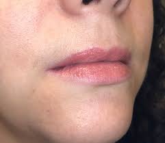 lips bellametrics