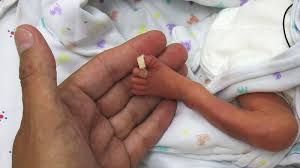 Your baby is now as hefty as a head of cauliflower, weighing in at almost 2 pounds and measuring roughly 14 1/2 inches. Gestational Age And Medical Needs Tommy S