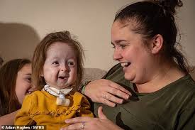 İki yaşlı qız "qoca nənə"yə çevrildi