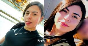 Joven jinete comparte cruda foto para probar la importancia de usar casco