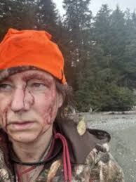 Juneau hunters recount brown bear attack that left one battered, but alive