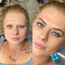 Profile for Suzanne Wylde Permanent Cosmetics & Medical Micropigmentation