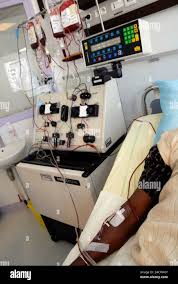 Image result for Apheresis