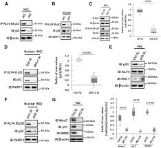Smooth muscle vector illustration diagram, anatomical scheme with human gut. Hyperglycemia Induces Vascular Smooth Muscle Cell Dedifferentiation By Suppressing Insulin Receptor Substrate 1 Mediated P53 Klf4 Complex Stabilization Journal Of Biological Chemistry