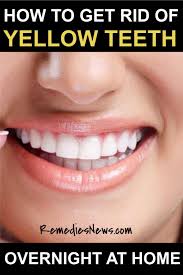 These two products work together to lift stains from teeth without being overly abrasive. How To Whiten Teeth Overnight Reddit Arxiusarquitectura