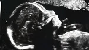 Häufig gestellte fragen zum thema schwangerschaftstest: Schwangerschaft Zu Viel Ultraschall Beim Frauenarzt Gesundheit Sz De
