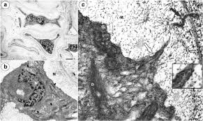 Check spelling or type a new query. Integument Cell Gelatinisation The Fate Of The Integumentary Cells In Hieracium And Pilosella Asteraceae Springerlink