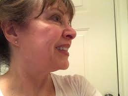 Bruce R Nelson, MD, 7737 Southwest Fwy, Ste 930, Houston, TX 77074, US