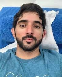 Should I recreate saved nail pictures?