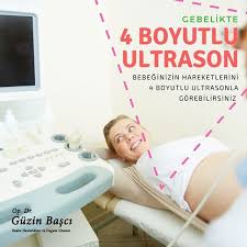 4 Boyutlu Ultrason 4d Ultrason Ozellikle Gebelik Takibinde Kullandigimiz Ultrason Cihazlarinin 2 Boyutlu Bebegi Goruntulemesi Ve Ol Instagram Cihaz Yuzler
