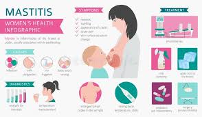 Table of contents how long does mastitis last? Mastitis Stock Illustrations 176 Mastitis Stock Illustrations Vectors Clipart Dreamstime