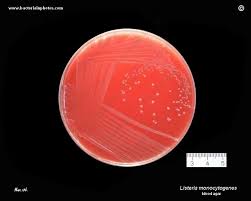 Enzyme linked immunofluorescent assay (elfa) vidas 1999. Listeria Monocytogenes