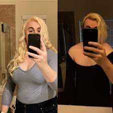 28, MtF] Breast development at 2 months & 11 months HRT : r/transtimelines