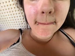 My eyes guys are red like so red 😭 what can I use for my eyes to be white  🥺?