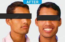 Best Orthodontist in Mumbai