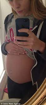 And bloating accompanied by abdominal distension (visible swelling in your stomach) could be a red flag that there is a problem. Woman Told Her Stomach Cramps Were Growing Pains Diagnosed With Cervical Cancer Daily Mail Online