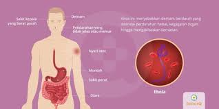 Spanish flu, also known as the great influenza epidemic or the 1918 influenza pandemic, was an exceptionally deadly global influenza pandemic caused by the h1n1 influenza a virus. Ebola Tanda Dan Gejala Penyebab Cara Mengobati Cara Mencegah